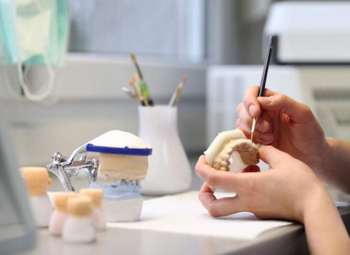 Finalisation esthétique implant Ajaccio