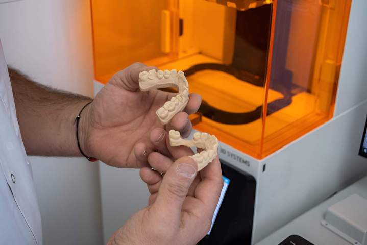 Modèles de mâchoire imprimés en 3D par un technicien Ajaccio